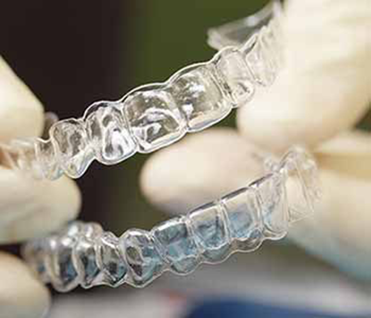 Hamilton, ON, Dr. Karen Ho provides custom mouth guards for patients with teeth grinding habits
