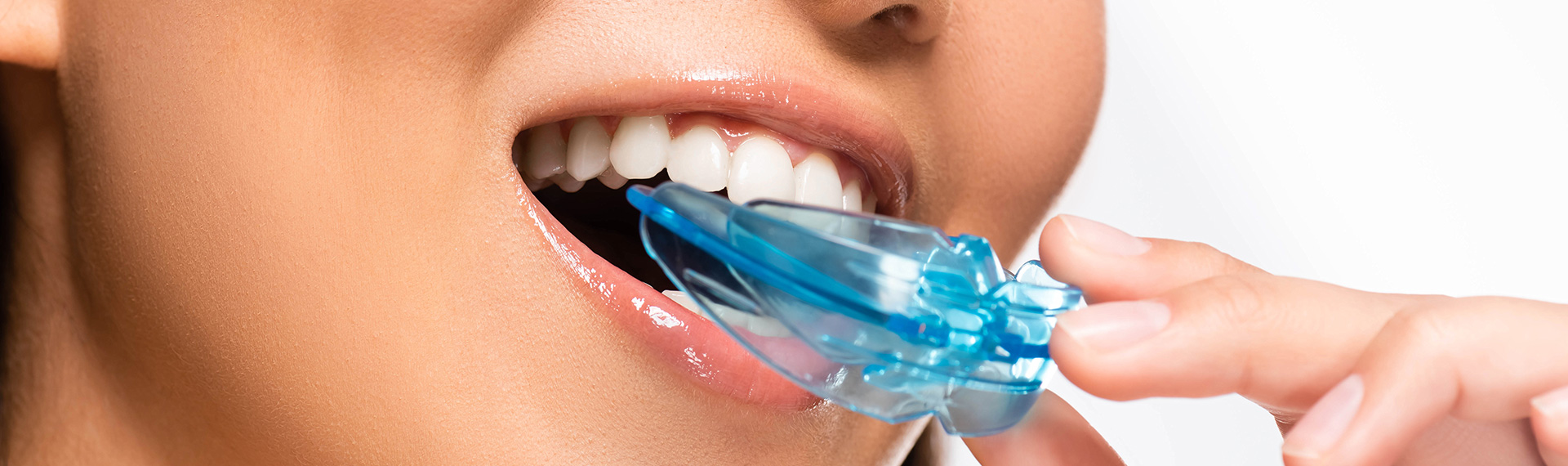 Learn More About Dental Mouth Guards Near Me In, Hamilton Ontario Area